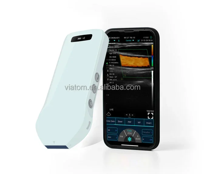 Viatom ABCDE Portable Wireless Ultrasound Scanner 192 Elements Handheld High Frequency Linear Color Wireless Ultrasound Probe