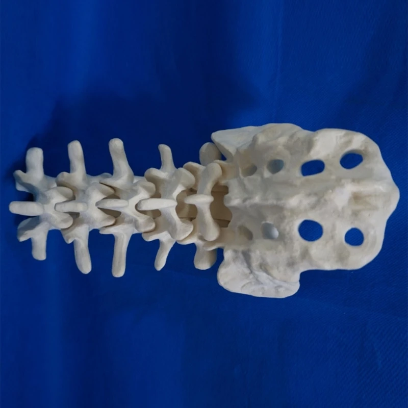 Human Lumbar Vertebrae Model with Sacrum Teaching Tool Lumbar Vertebrae Anatomically Model for Student Study Display Y3NC