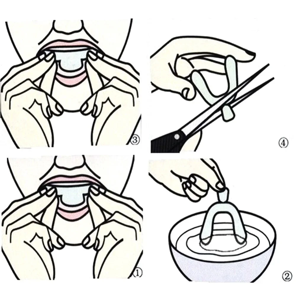 Sdotter New 2/4pcs Silicone Orthodontic Braces Dental Teeth Whiten Braces Bleaching Molding Trays Custom Moldable Thermoform Tee