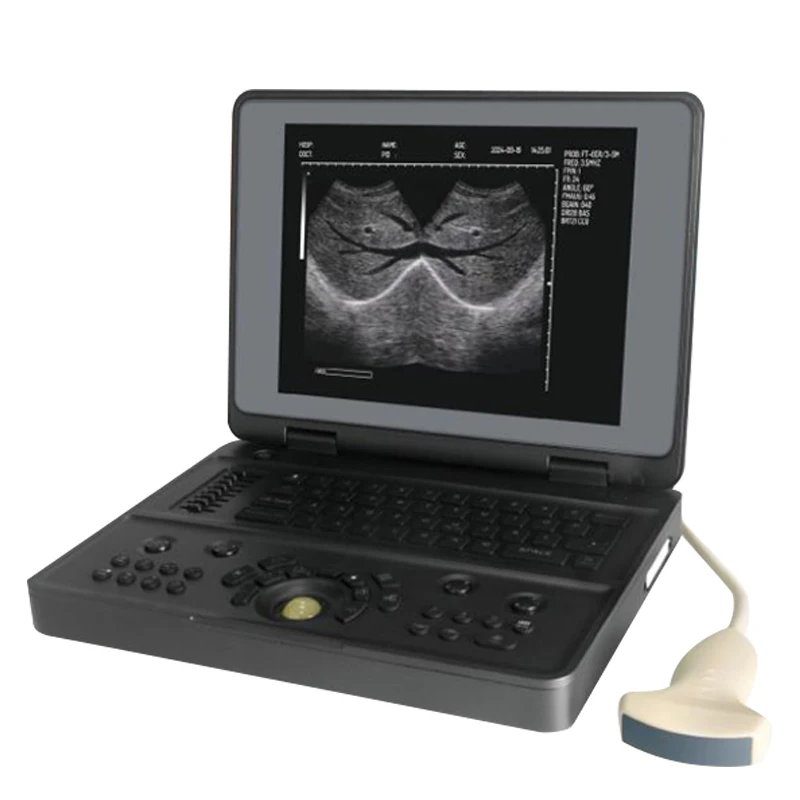 YSENMED YSB3000W Full Digital Ultrasound Imaging System Notebook Style Black And White Ultrasound Scanner