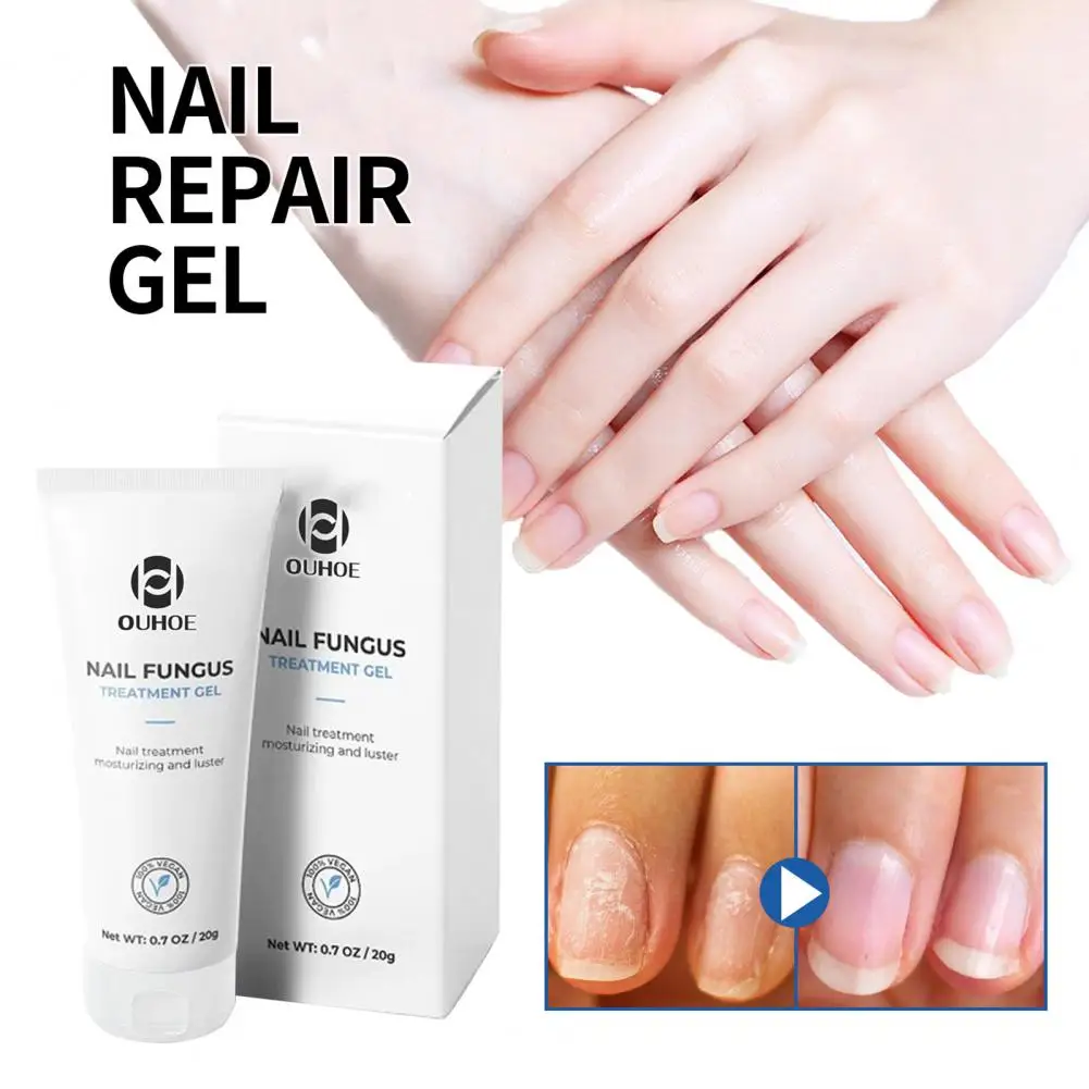 Nail Repair Gel Effective Nail Treatment Gel for Strengthening Repairing Beautifying Nails Long Lasting for Manicure