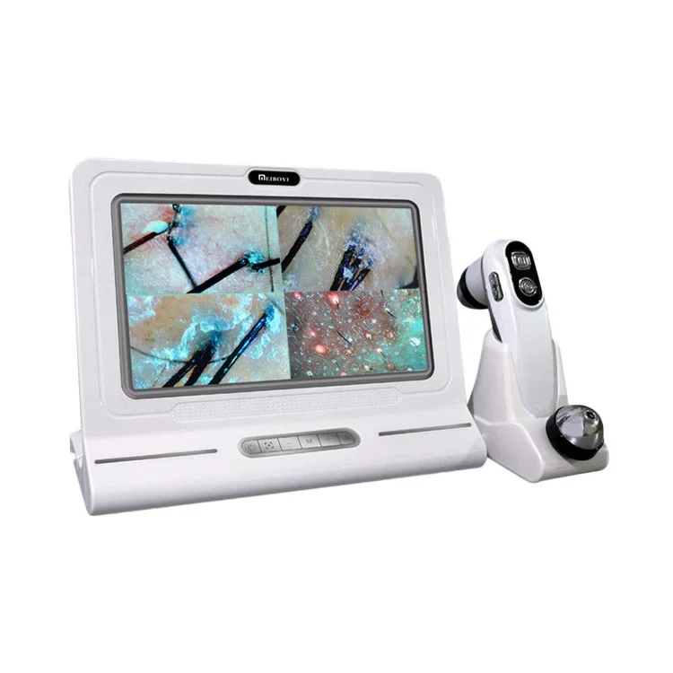 HD digital microscope hair follicle detector scalp hair analyzer for scalp follicle skin test