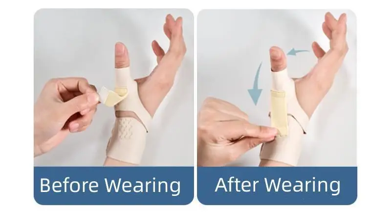 Handgelenk Daumen Unterstützung Klammer Weiche Elastische Daumen Kompression Hülse Schutz Daumen Spica Schiene Leichte Armband Gym Sport – Detail 10