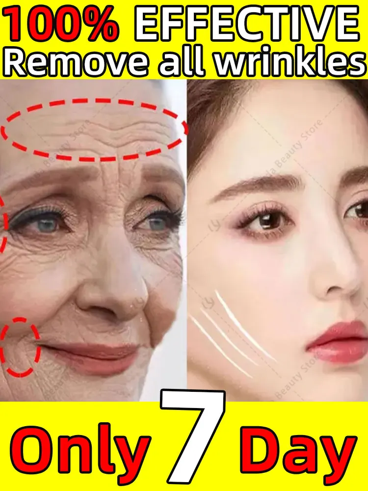 

Eliminate Neck Lines