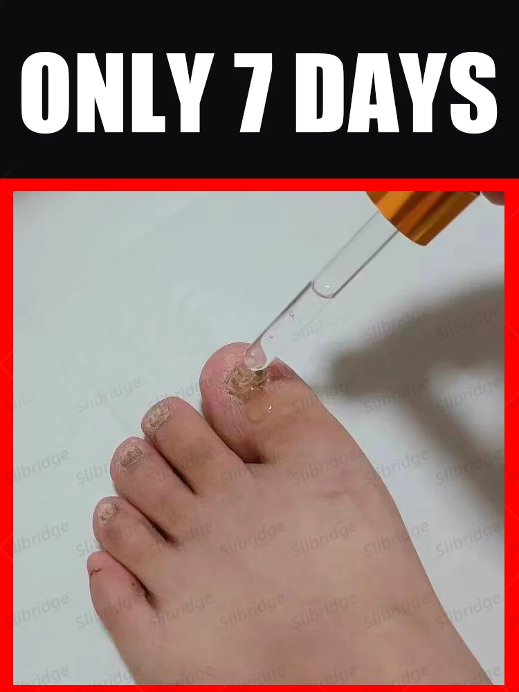 

Cleaning Nail Manicureed Waterproof Nail Repair Patches Nail Ingrown Correction Sticker Discolored Damaged Nail Foot Care Tool