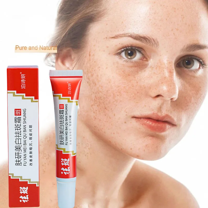 

Freckle Whitening Cream Black Dots Melasma Remover Anti Brown Stain Lighten Pigmentation Moisturizing Skin Care Products