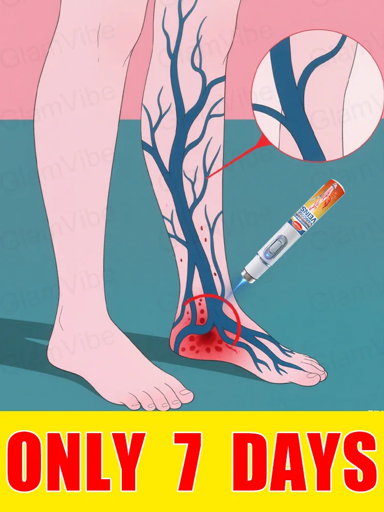 

blue light pen solve varicose veins, hot sale leg care tools