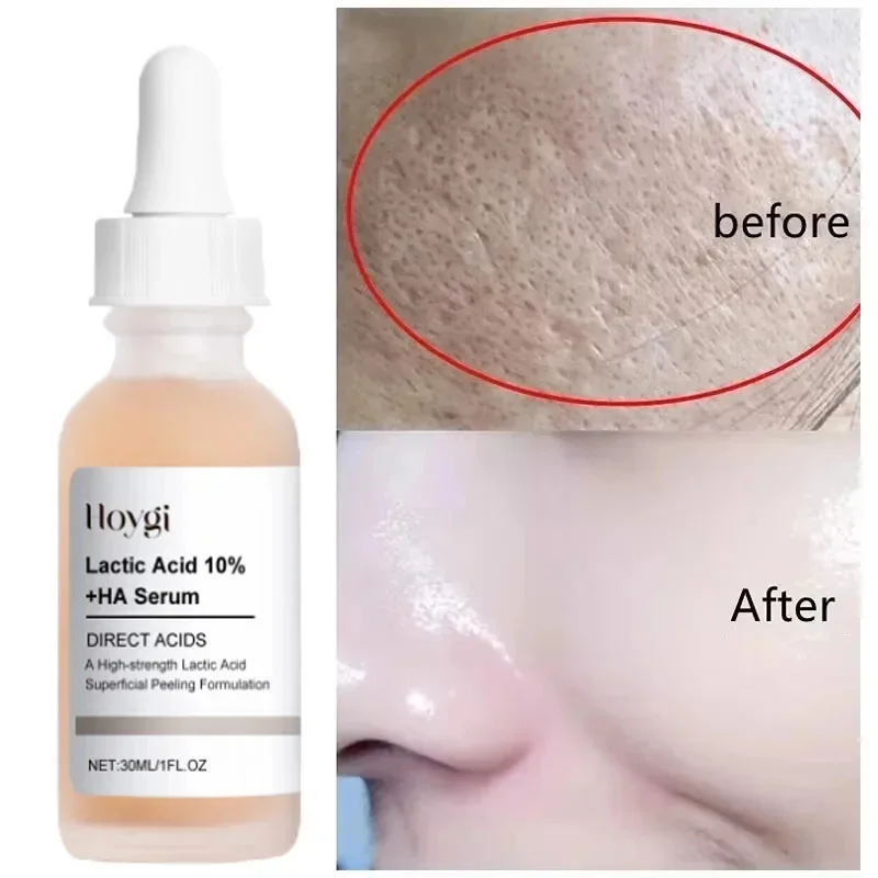 

Lactic Acid Pore Shrinking Serum Blackheads Acne Removal Tightening Minimizing Pore Oil Control Moisturizing Smooth Skin Care