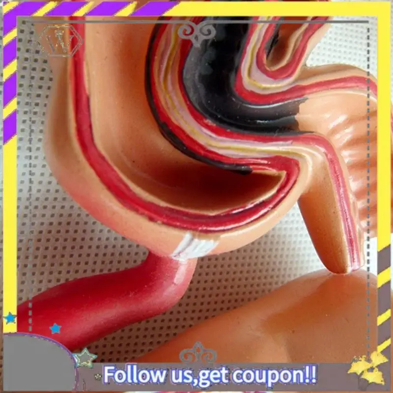 New Teaching Model,Human Large Intestine Anatomy Model Visceral Lesion Model Human Digestive System Learning Model Easy Install