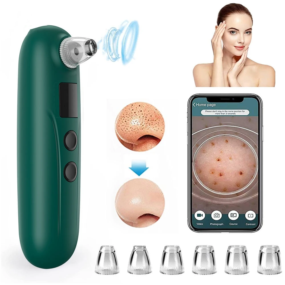 مصاصة الرؤوس السوداء الكهربائية، مزيل الرؤوس السوداء وحب الشباب، مستخرج الوجه الساخن، مزيل الرؤوس السوداء البصرية، آلة تنظيف عميق للوجه #3
