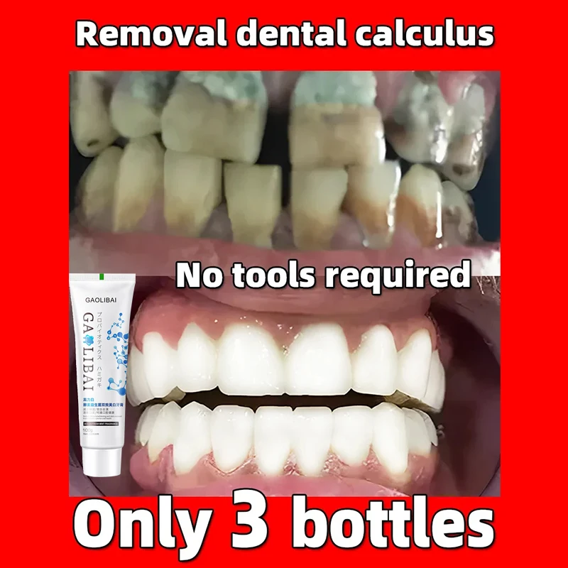 

100g Teeth Whitening Toothpaste Removal Bad Breath Stains Teeth Whitener Preventing Periodontitis Cleaning Dental Product