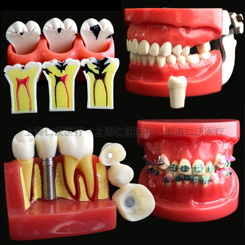 Various dental models for teaching and hospital dental materials