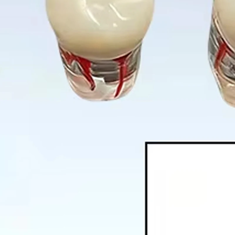 

Набор из 10 стандартных съемных моделей зубов 1:1 с корневыми каналами и пульпой для обучения студентов