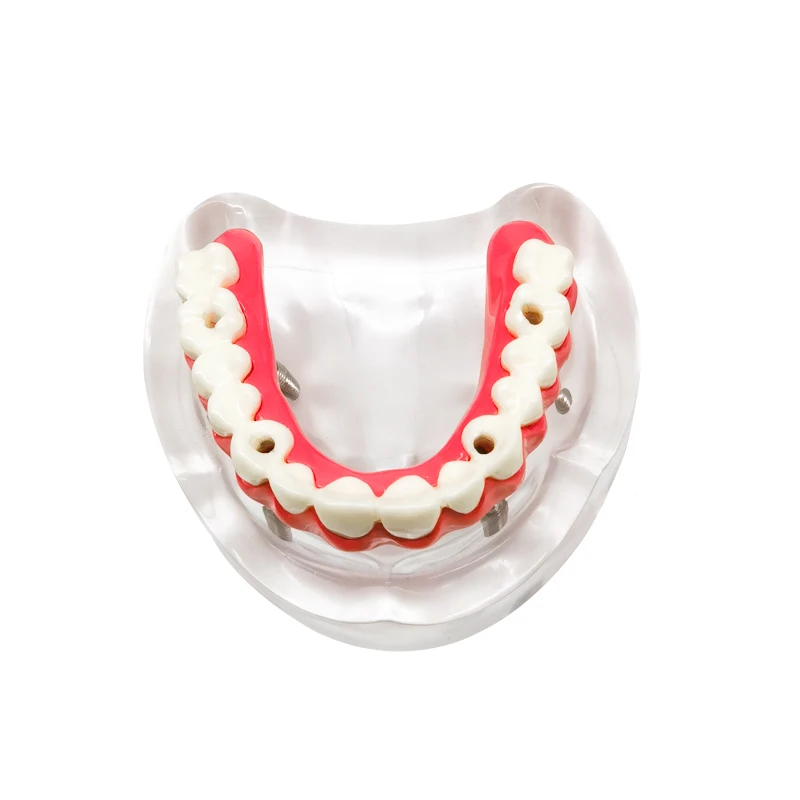 Thumbnail 3 - #67 Dental Teaching Models List of Top Picks