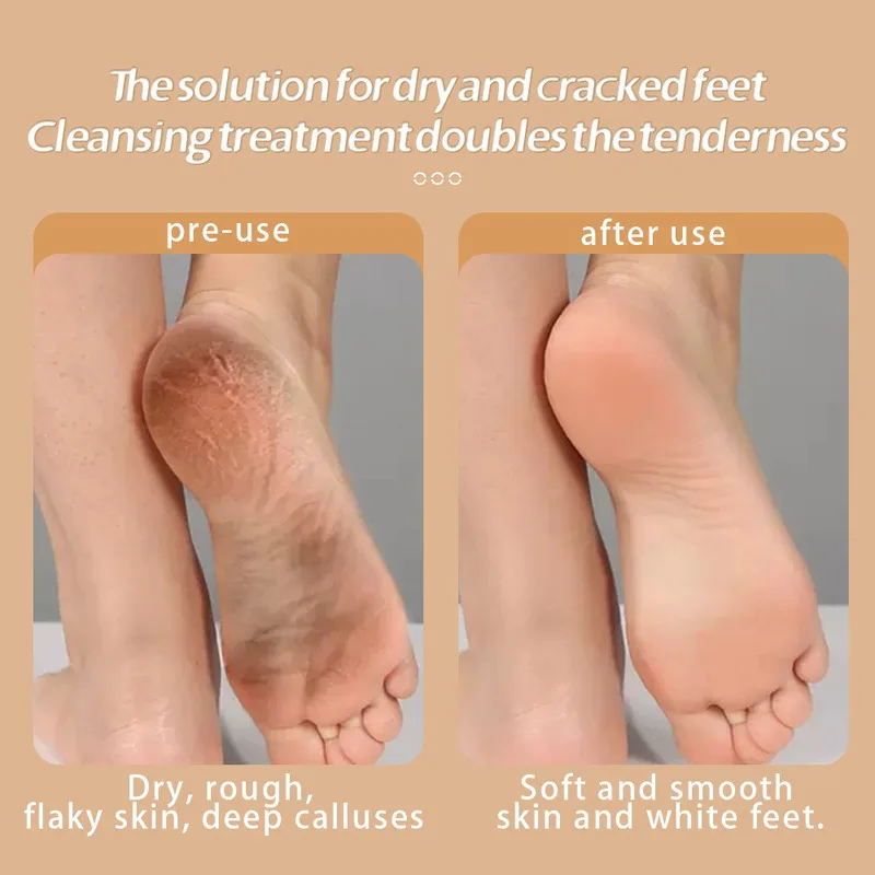 مطحنة القدم الكهربائية السيارات اللاسلكية إزالة الجلد الميت النسيج الشقوق الصلب متصدع الجلد باديكير أداة مقاوم للماء منظف القدمين