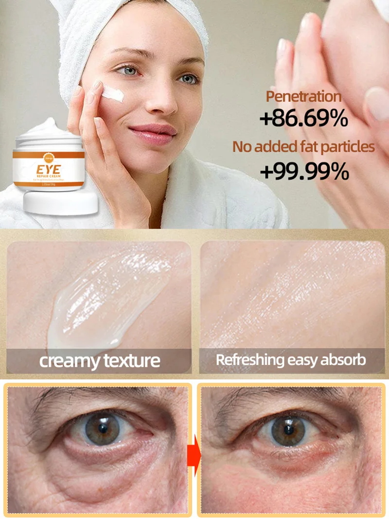 Under eye creams