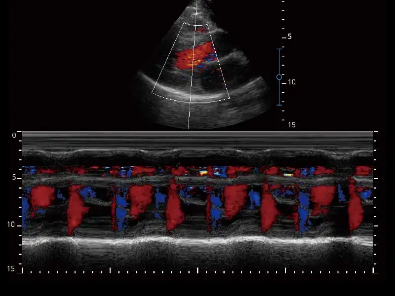 Sonoscape E2 Fabrieksprijs Laptopscanner Ultrasone diagnostische apparatuur Machine Draagbaar
