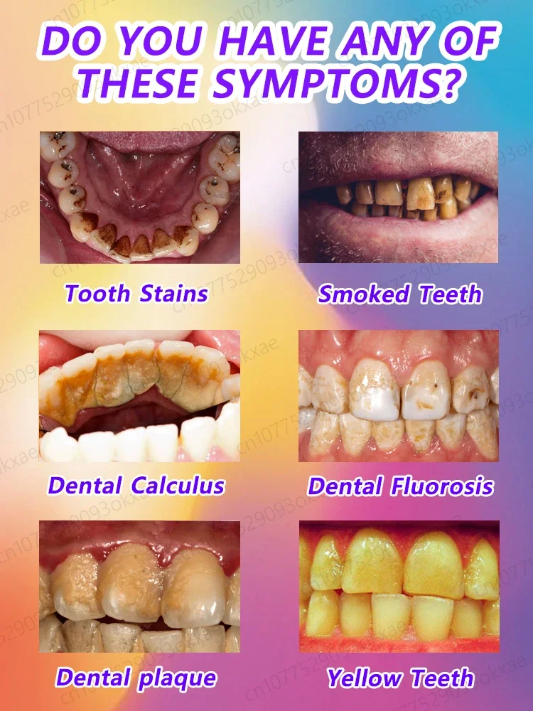 Dentes branqueamento espuma rapidamente branquear os dentes, Remover manchas de dente, Livrar-se da placa, Limpar os dentes