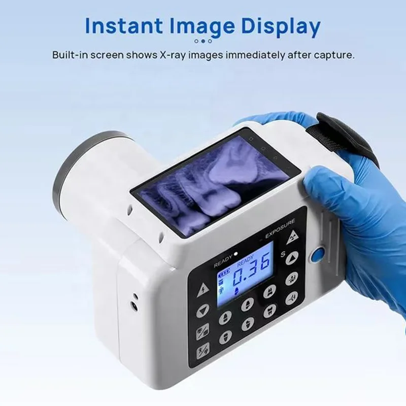 LK-C14 Angle Calibration Instant Image Display Portable Dentl Digital X-Ray Unit with RVG Sensor
