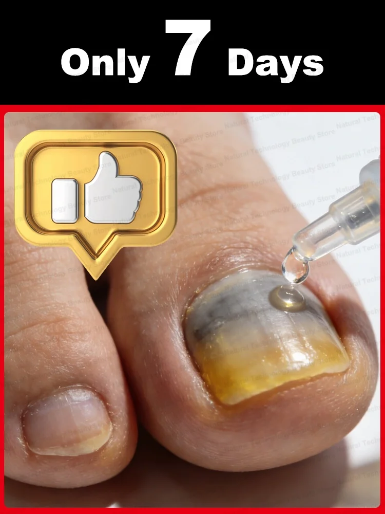 

Водонепроницаемые корректирующие наклейки для ногтей 2026: лечение грибка, восстановление вросших и поврежденных ногтей, уход за стопами