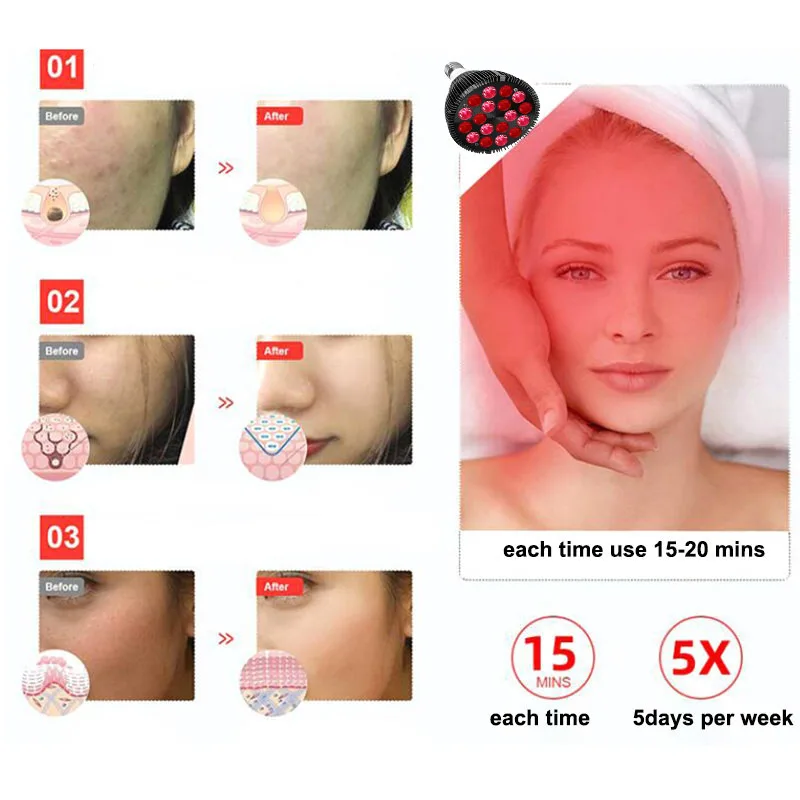 

Powerful Red Light Therapy Bulb Anti Aging E27 660nm 850nm Near Infrared IR Lamp Therapy for Skin Pain Relief plant Grow Light