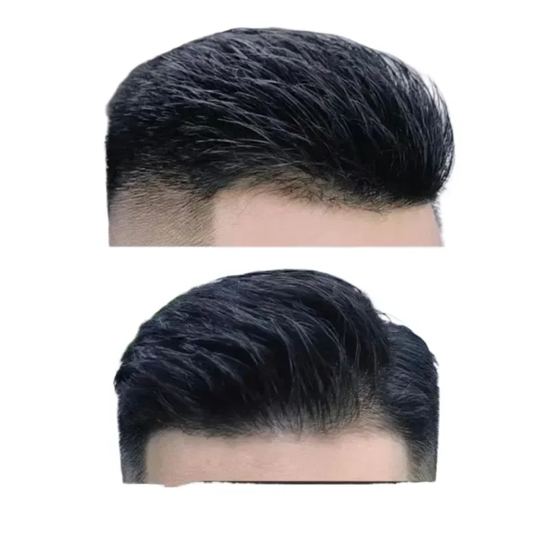 Men's high-end wig back head hairline wig sticker forehead invisible real hair bald M-shaped reissue block biological scalp