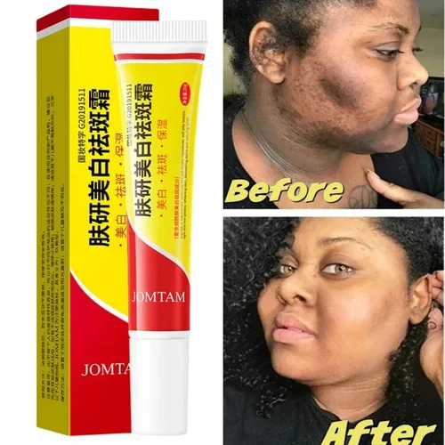 Crema iluminadora facial, niacinamida, Reduce cloasma, melasma, melanina, desvanece las líneas finas, aclara la piel oscura, suero, crema iluminadora para el cuidado