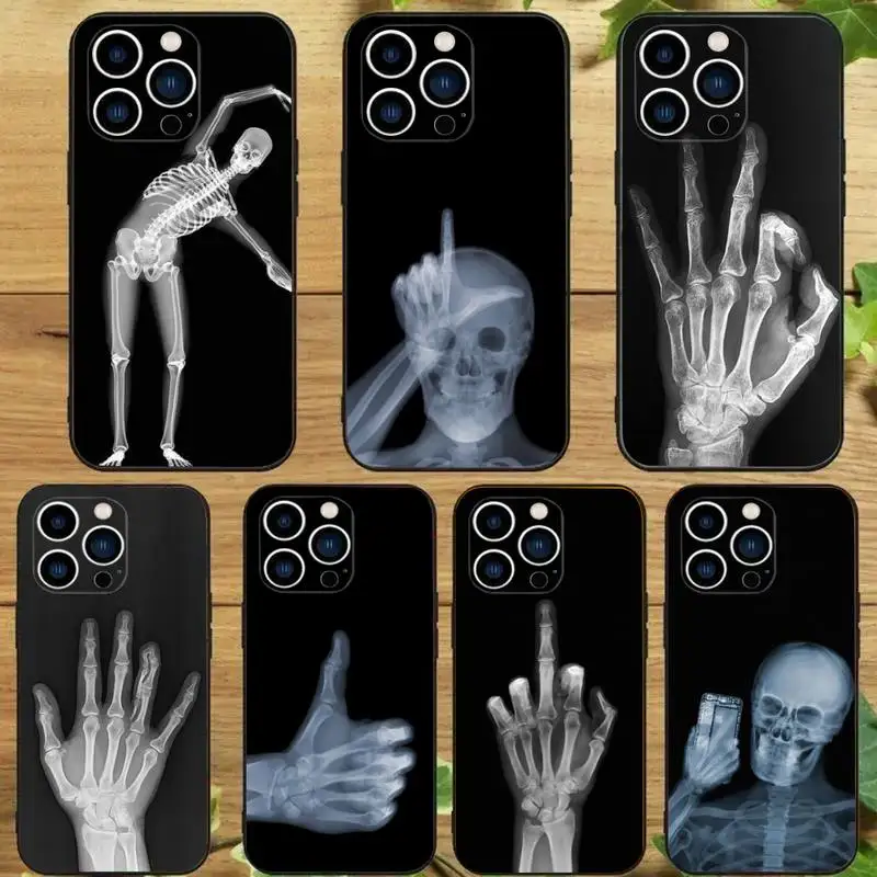 Radiological Human Skeleton Phone Case For iPhone 15 14 13 12 11 Pro Max Xs Xr X 7 8 Plus 12 13 Mini Silicone Black Cover