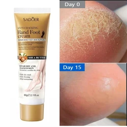 Creme Anti-Crack Hand Foot, Salto Anti-Secagem, Reparação rachada, Remoção de máscara de pés, Pele morta, Hidratante, Branqueamento dos pés