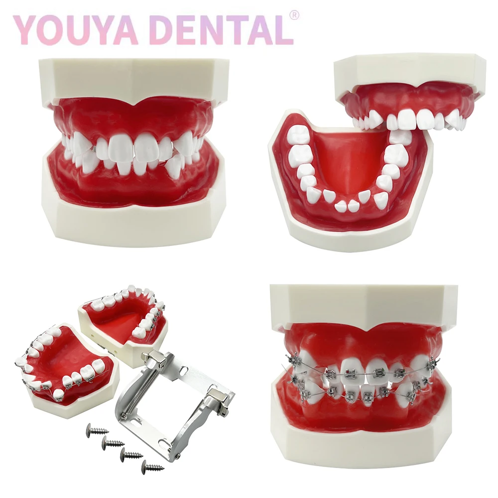 Dental Red Wax Gum Malocclusion Teeth Model Orthodontic Repositioning Practice Deformity Model Dentist Education Demonstration