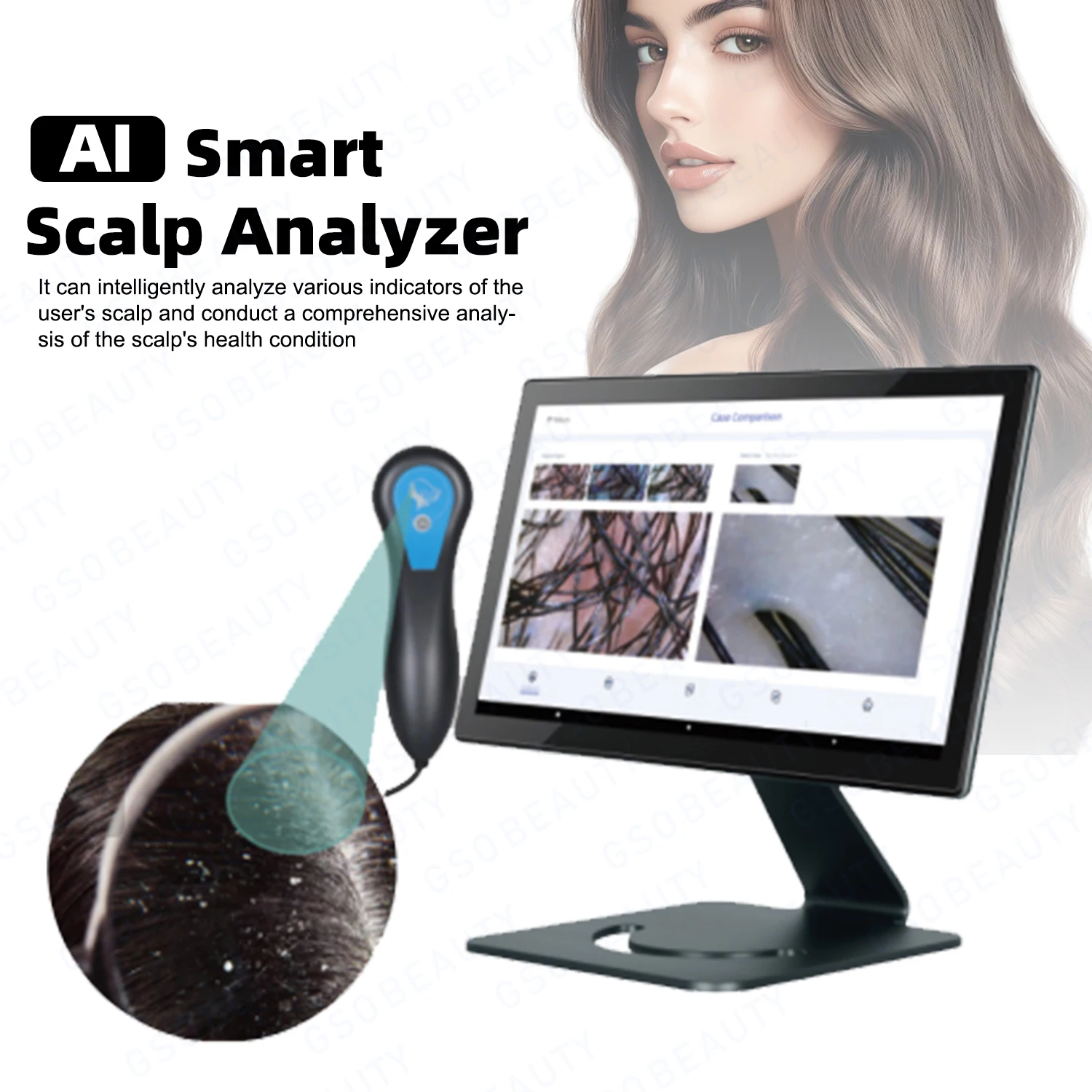 T1 Professional AI Intelligent Scalp Analyzer, 14-inch high-definition display, three-spectrum RGB UV PL 50X/200X magnification
