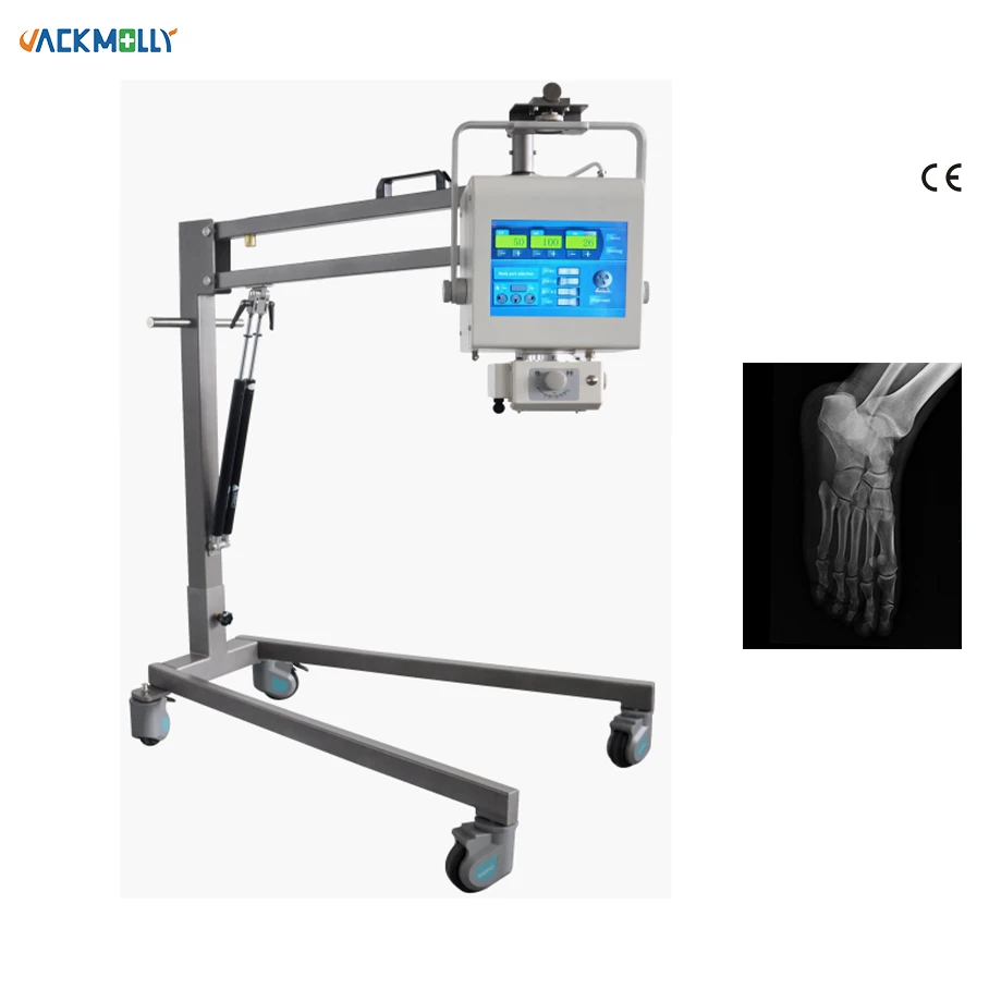 medical hospital high frequency x ray equipment 60mA portable mobile x-ray machine price