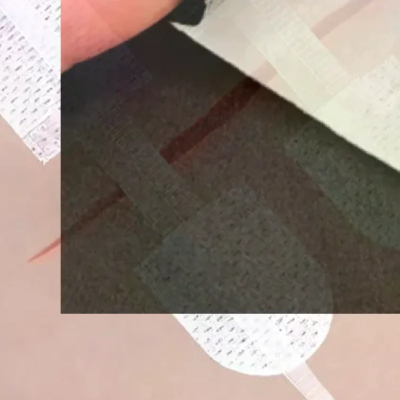 Strap Zipper Wound Closure Patches Breathable Seamless Elastic Zip Sutures Bandages For Wound Care Braces Supports