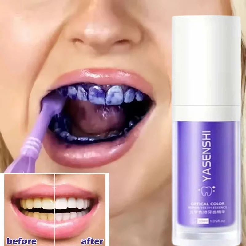 

30ml Whitening Toothpaste FreshingTeeth Oral Hygiene Deep Cleaning Removes Tartar Brightening Teeth Oral Care Products New