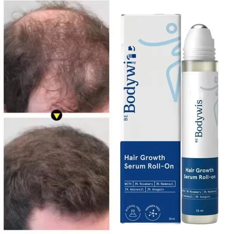 Anti-Hair Fall Growth Serum Roll-On 25ml Be Bodywise Rosemary Advanced Hair Growth Increases Density Hair Roller Essence Massage