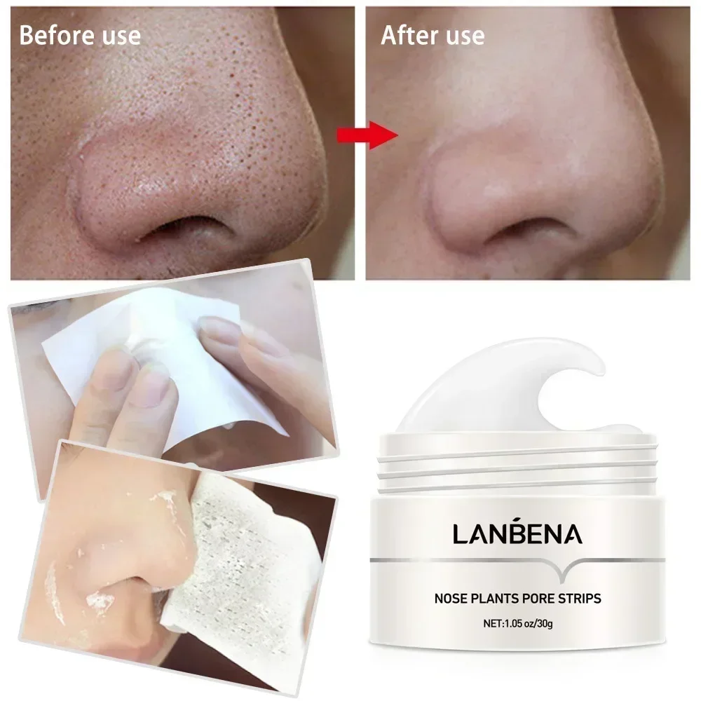 Lanbena Removes Blackhead Nasal Membrane Nasal Strip Deep Cleansing Blackhead Acne Cleaner Pores Peeling Korea Skin Care Product