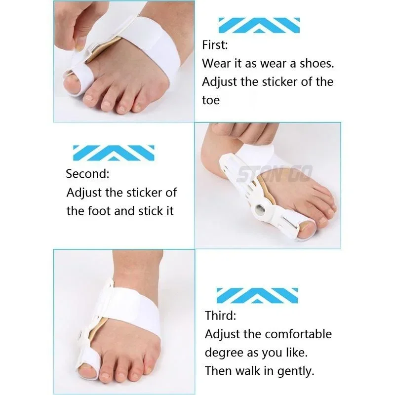 大きな外反母趾用スプリント、外反母趾矯正装具、整形外科用足痛緩和矯正器、外反母趾矯正