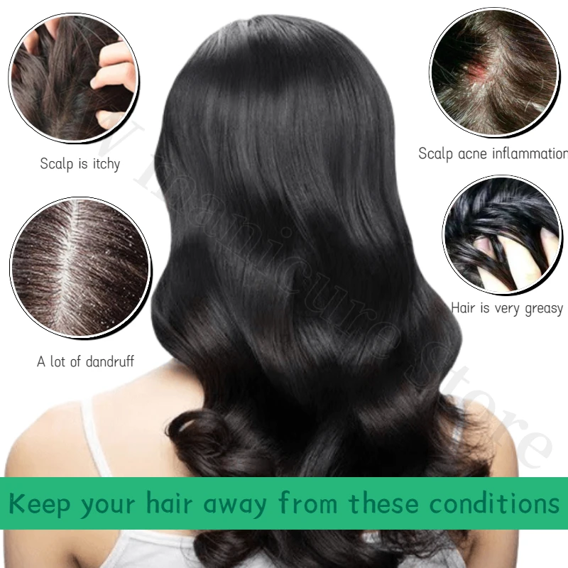 OFS Shampoo Oil Control Fluffy Anti-itching Anti-dandruff Nourishing Scalp Shampoo Anti-hair Loss Unisex Hair Care Shampoo 400ml