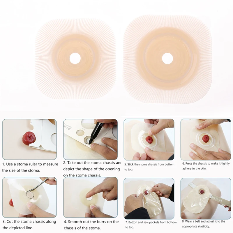 

1Pcs Colostomy Bags Baseplates Hydrocolloid Stoma Care Durable Skin Barriers Ostomy Bags Plates