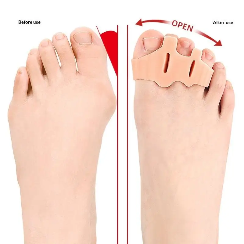 Thumbnail 4 - #18 Pedicure Spacers Comparison Guide