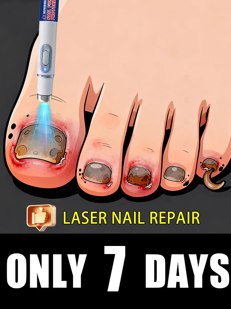 

Laser treatment for nail fungus and removal of onychomycosis