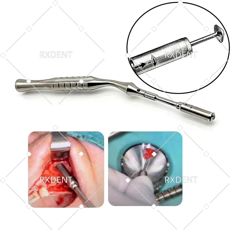 

Набор хирургических скребков для костной ткани из нержавеющей стали для дентальных имплантатов: костеотсос и скейлер для чистки зубов