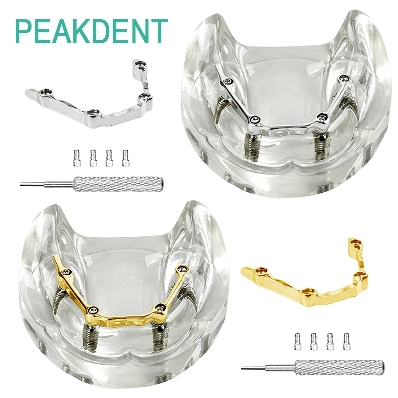 

1 шт., съемный зубной имплантат, серебряный/золотой стержень, тренировочная модель, стоматологическая лабораторная практика, обучающая демонстрационная модель