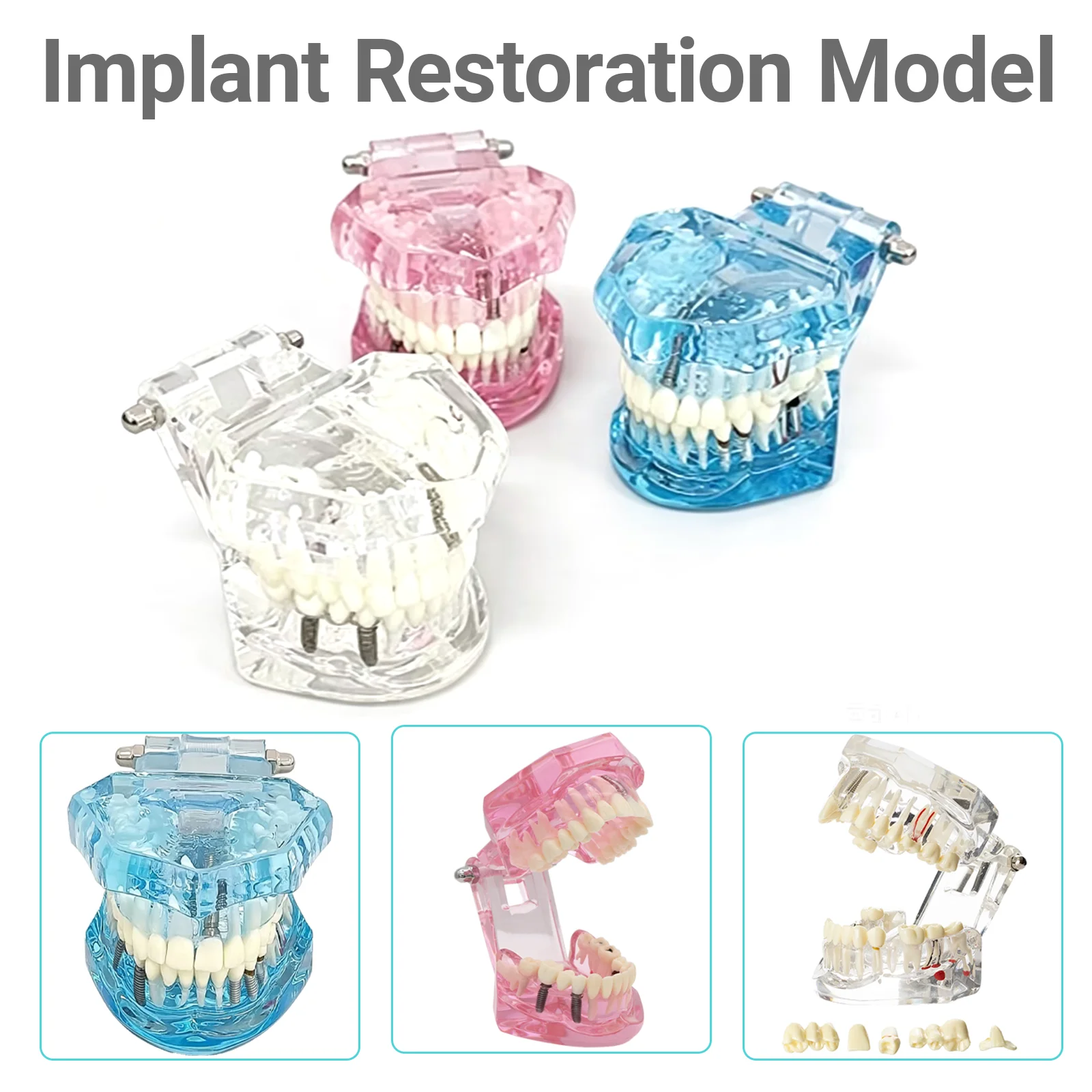 Dental Removable Teeth Models Dental Implant And Restoration Model Teeth Implant Restoration Bridge Teaching Demonstration