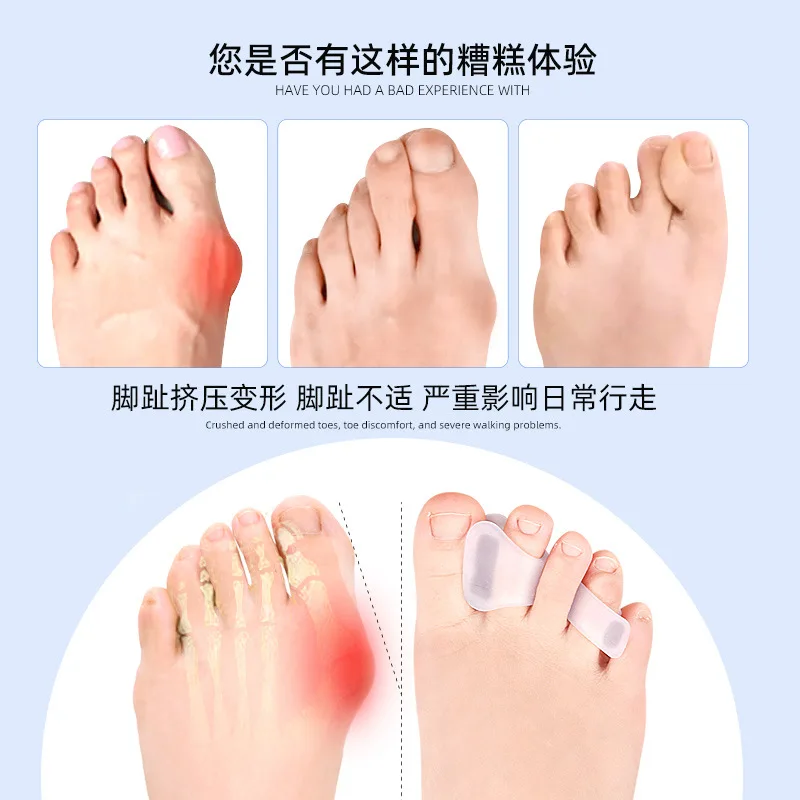 발톱무좀 2pcs Hallux Valgus Foot Care Pedicure Silicone Gel Straightener Two Hole Toe Separator Fingers Protector Bunion Adjuster