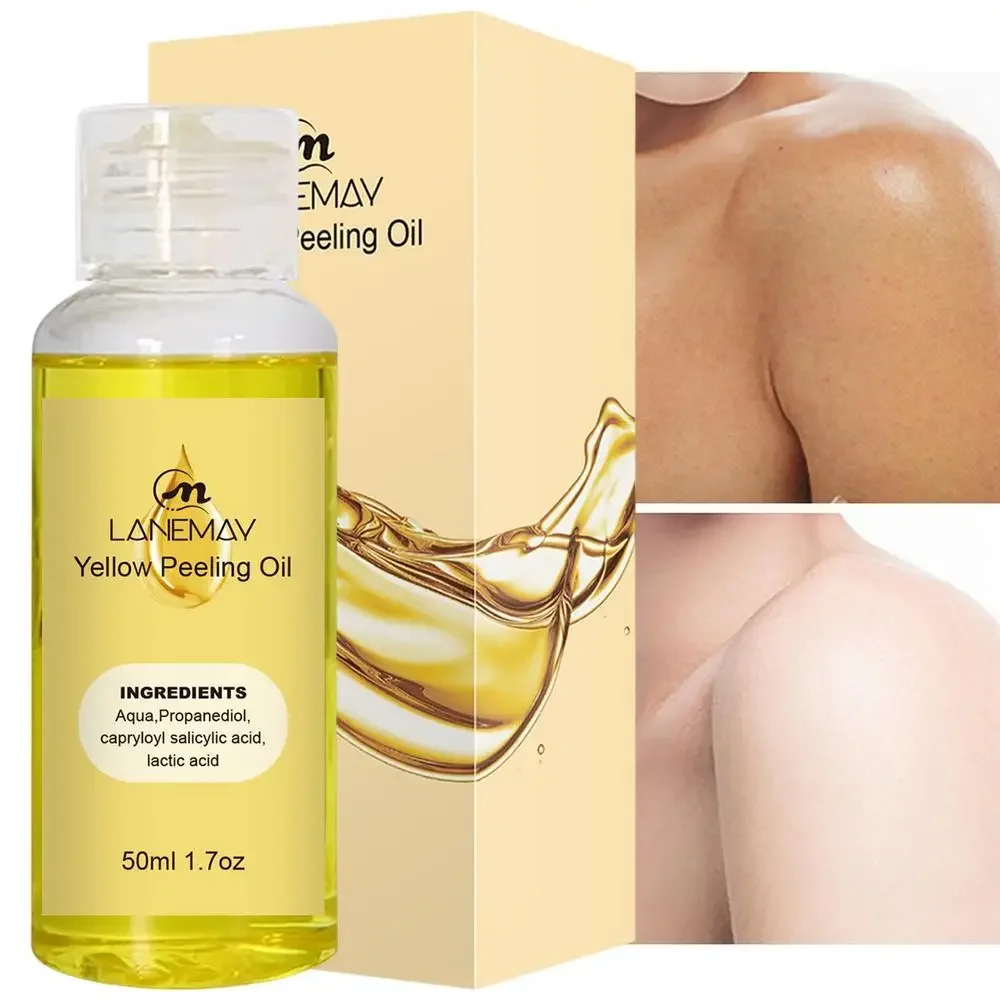 Yellow Peeling Oil Lighten Elbows Knees Hands Melanin Strong Yellow Peeling Oil Even Skin Tone And Whiten Skin Care Supplies