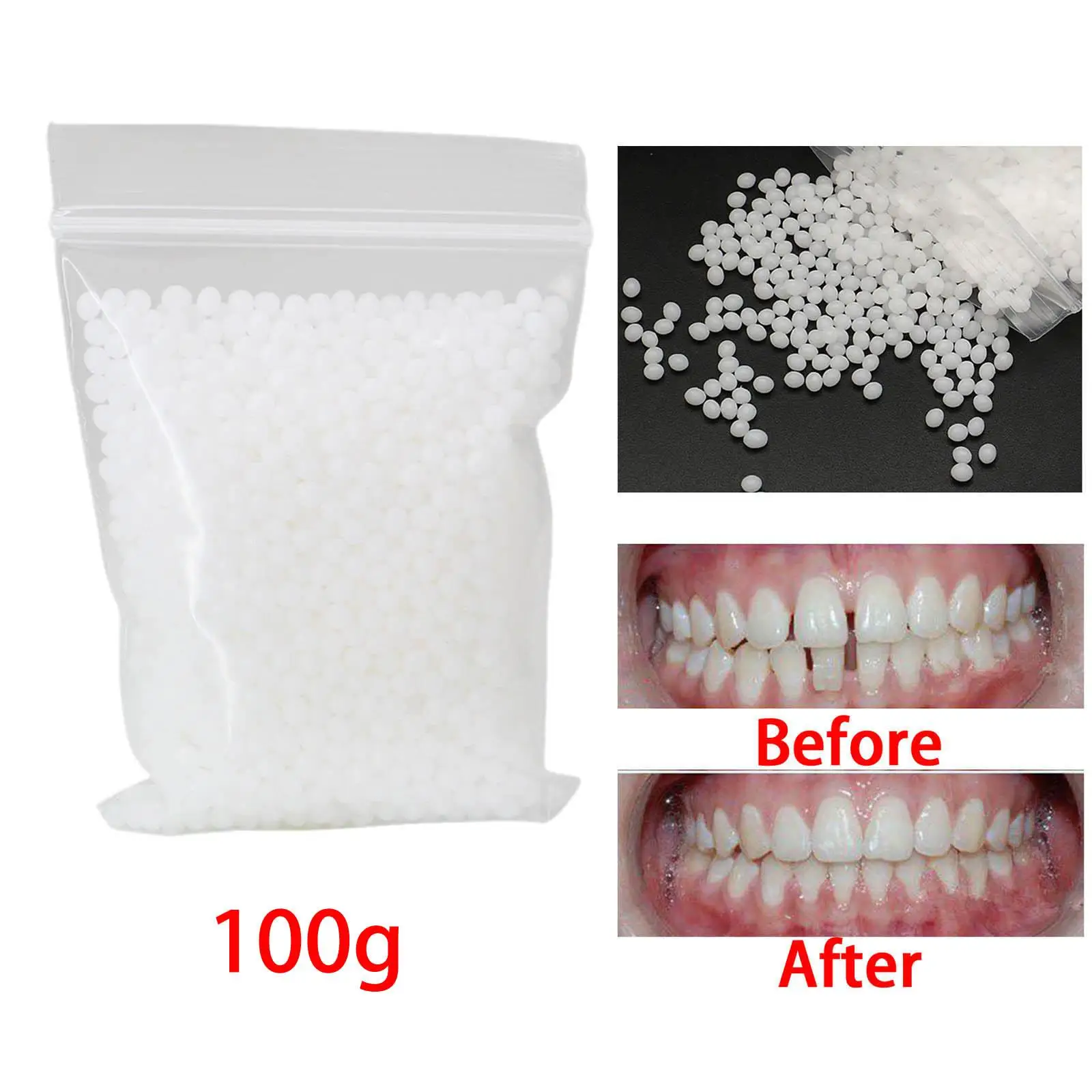 100G Temporary Tooth Repair Kit Thermal Tooth Filler Beads False for Broken