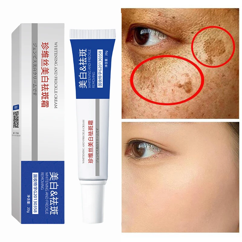 

Whitening Freckle Face Cream Pigmentation Dark Spots Remover Melasma Lightening Beauty Face Moisturizer Korean Skin Care 20g