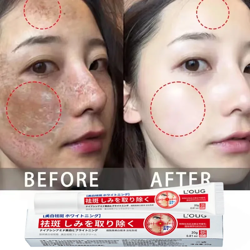 Mild Powerful Niacinamide Whitening Blemish Cream Lightens Melanin Dull Pigment Melasma Dark Spots Moisturizes Korean Skin Care