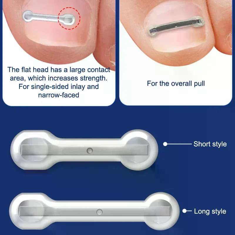 Ingrown Toenail Treatment Kit With 4 Multi-Sizes,Titanium Alloy Ingrown Nail Corrector Tools For Curved Toenail Corrector 10Pcs
